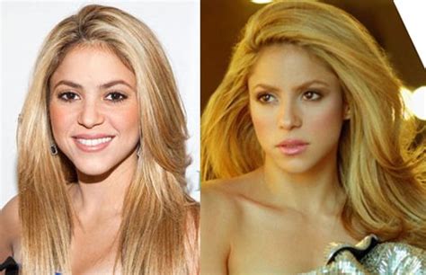 shakira breast implants|Celebrities with Breast Implants 